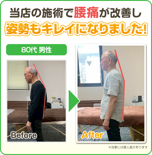 ビフォーアフター