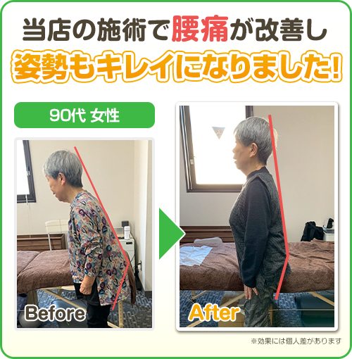 ビフォーアフター