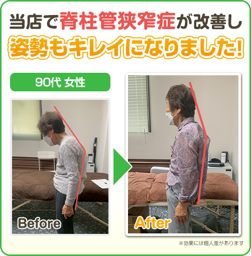 ビフォーアフター