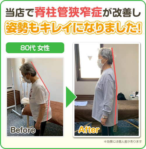 ビフォーアフター