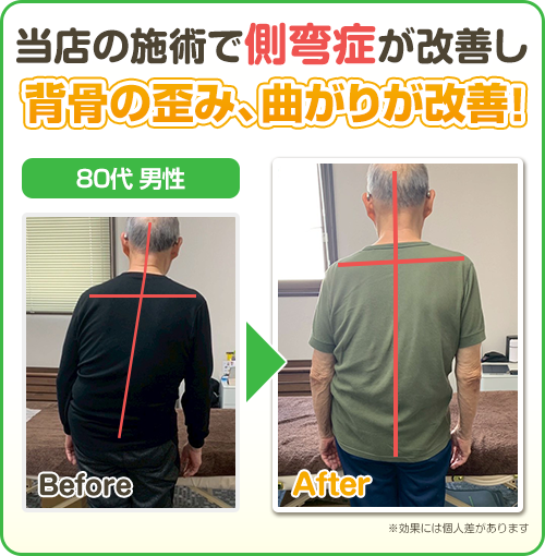 ビフォーアフター