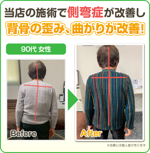 ビフォーアフター