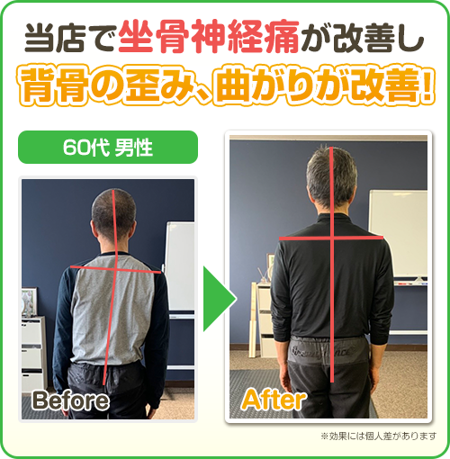 ビフォーアフター