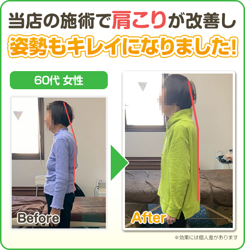 ビフォーアフター