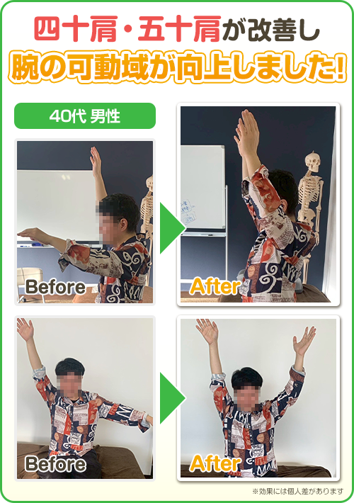 ビフォーアフター